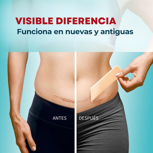 Cinta de silicona para cicatrices