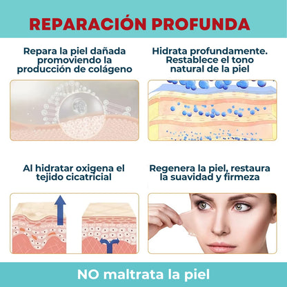 Cinta de silicona para cicatrices